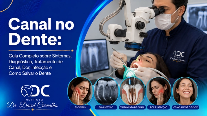 Canal no Dente: Guia Completo sobre Sintomas, Diagnóstico, Tratamento de Canal, Dor, Infecção e Como Salvar o Dente