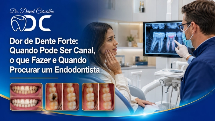 Dor de Dente Forte: Quando Pode Ser Canal, o que Fazer e Quando Procurar um Endodontista