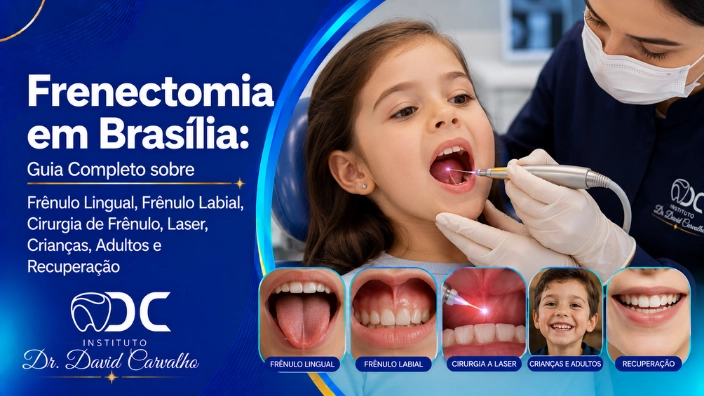 Frenectomia em Brasília: Guia Completo sobre Frênulo Lingual, Frênulo Labial, Cirurgia de Frênulo, Laser, Crianças, Adultos e Recuperação