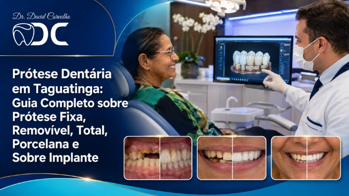 Prótese Dentária em Taguatinga: Guia Completo sobre Prótese Fixa, Removível, Total, Porcelana e Sobre Implante