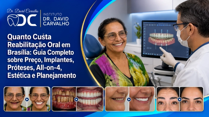 Quanto Custa Reabilitação Oral em Brasília: Guia Completo sobre Preço, Implantes, Próteses, All-on-4, Estética e Planejamento