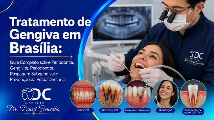 Tratamento de Gengiva em Brasília: Guia Completo sobre Periodontia, Gengivite, Periodontite, Raspagem Subgengival e Prevenção da Perda Dentária